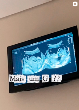 Post 17 da 3G